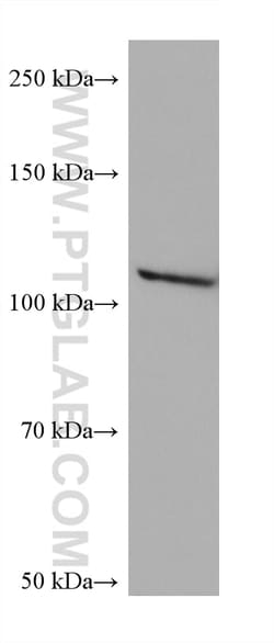 NNT Mouse Monoclonal Antibody, Proteintech Unconjugated; 20 &mu;L:Antibodies,