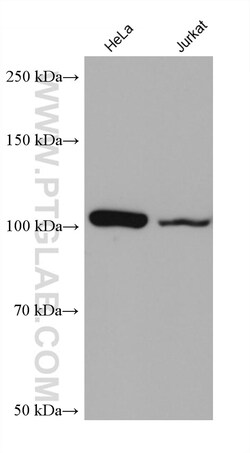 NNT Mouse Monoclonal Antibody, Proteintech Unconjugated; 20 &mu;L:Antibodies,