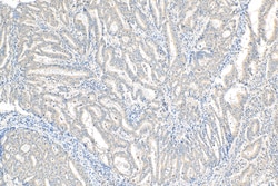 NODAL Rabbit Polyclonal Antibody, Proteintech:Antibodies:Primary Antibodies