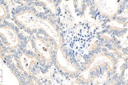 NODAL Rabbit Polyclonal Antibody, Proteintech:Antibodies:Primary Antibodies