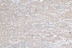NODAL Rabbit Polyclonal Antibody, Proteintech:Antibodies:Primary Antibodies