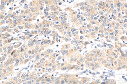 NODAL Rabbit Polyclonal Antibody, Proteintech:Antibodies:Primary Antibodies