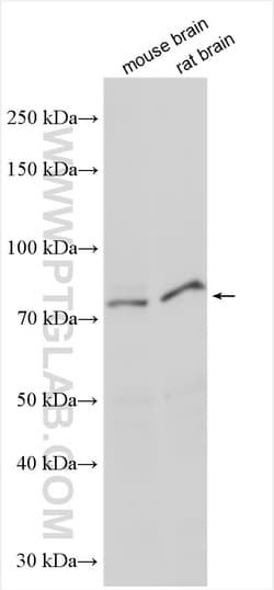 NOL11 Rabbit Polyclonal Antibody, Proteintech Unconjugated; 20 &mu;L:Antibodies,