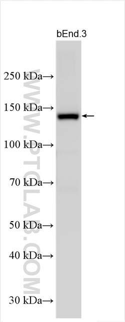 eNOS Rabbit Polyclonal Antibody, Proteintech Unconjugated; 150 &mu;L:Antibodies,