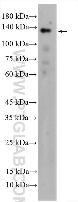 eNOS Rabbit Polyclonal Antibody, Proteintech Unconjugated; 150 &mu;L:Antibodies,