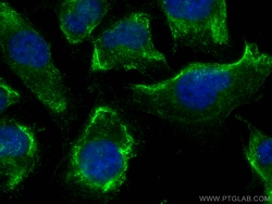 NOX4 Mouse Monoclonal Antibody, Proteintech 150 &mu;L | Buy Online | Proteintech | Fisher Scientific