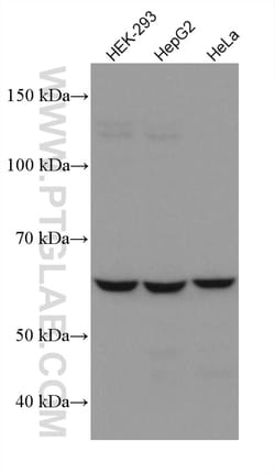 NOX4 Mouse Monoclonal Antibody, Proteintech 150 &mu;L | Buy Online | Proteintech | Fisher Scientific