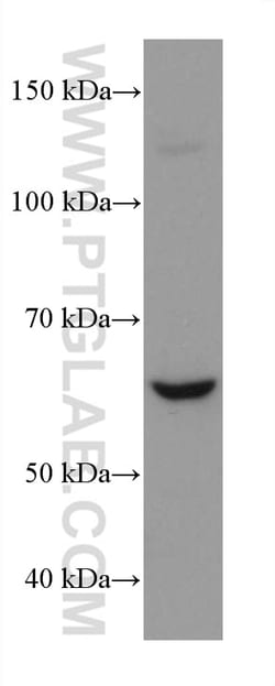 NOX4 Mouse Monoclonal Antibody, Proteintech 150 &mu;L | Buy Online | Proteintech | Fisher Scientific
