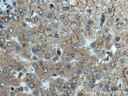 NPC1L1 Rabbit Polyclonal Antibody, Proteintech Unconjugated; 20 &mu;L:Antibodies,