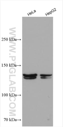 NPC1L1 Rabbit Polyclonal Antibody, Proteintech Unconjugated; 20 &mu;L:Antibodies,
