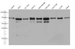 NPHP5/IQCB1 Mouse Monoclonal Antibody, Proteintech Unconjugated; 20 &mu;L:Antibodies,