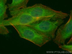 CoraLite Plus 488-conjugated NR3C2 Rabbit Polyclonal Antibody, Proteintech:Antibodies:Primary