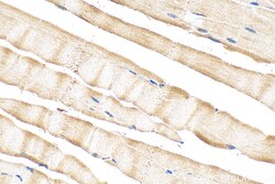 NRAP Rabbit Polyclonal Antibody, Proteintech Unconjugated; 20 &mu;L:Antibodies,