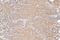 NRARP Rabbit Polyclonal Antibody, Proteintech 150 &mu;L | Buy Online | Proteintech | Fisher Scientific
