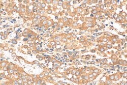 NRARP Rabbit Polyclonal Antibody, Proteintech 150 &mu;L | Buy Online | Proteintech | Fisher Scientific