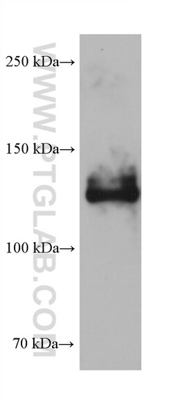 NRCAM Mouse Monoclonal Antibody, Proteintech Unconjugated; 20 &mu;L:Antibodies,