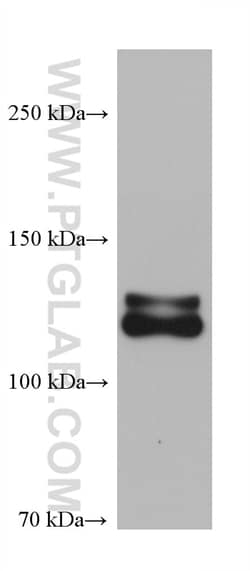 NRCAM Mouse Monoclonal Antibody, Proteintech Unconjugated; 20 &mu;L:Antibodies,