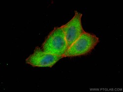 NSFL1C Mouse Monoclonal Antibody, Proteintech Unconjugated; 20 &mu;L:Antibodies,