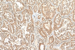 NSFL1C Mouse Monoclonal Antibody, Proteintech Unconjugated; 20 &mu;L:Antibodies,