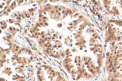 NSFL1C Mouse Monoclonal Antibody, Proteintech Unconjugated; 20 &mu;L:Antibodies,
