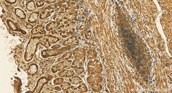 NUBP1 Rabbit Polyclonal Antibody, Proteintech Unconjugated; 20 &mu;L:Antibodies,