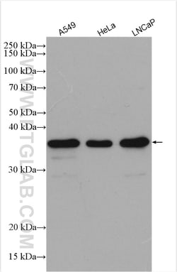 NUBP1 Rabbit Polyclonal Antibody, Proteintech Unconjugated; 20 &mu;L:Antibodies,