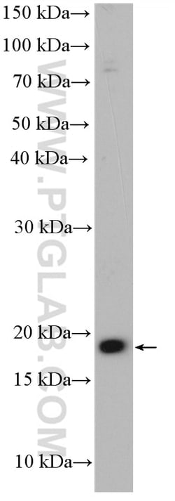 NUDT15 Rabbit Polyclonal Antibody, Proteintech Unconjugated; 150 &mu;L:Antibodies,