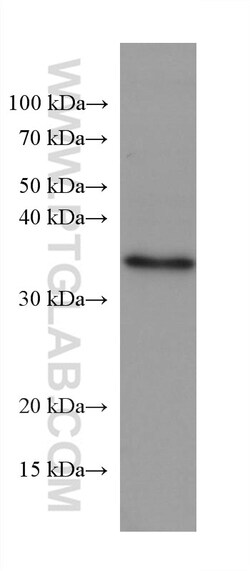 NUDT22 Mouse Monoclonal Antibody, Proteintech:Antibodies:Primary Antibodies