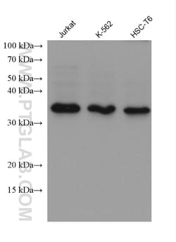 NUDT22 Mouse Monoclonal Antibody, Proteintech:Antibodies:Primary Antibodies