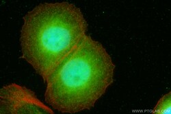 NUP85 Rabbit Polyclonal Antibody, Proteintech:Antibodies:Primary Antibodies