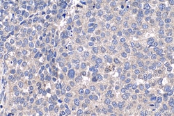NUP85 Rabbit Polyclonal Antibody, Proteintech:Antibodies:Primary Antibodies
