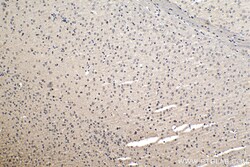 NUP85 Rabbit Polyclonal Antibody, Proteintech:Antibodies:Primary Antibodies