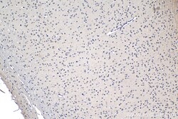 NUP85 Rabbit Polyclonal Antibody, Proteintech:Antibodies:Primary Antibodies