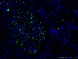 CoraLite™ Plus 488-conjugated Nestin Rabbit Polyclonal Antibody, Proteintech