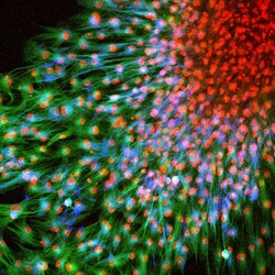 CoraLite Plus 488-conjugated Nestin Rabbit Polyclonal Antibody, Proteintech:Anticuerpos:Anticuerpos