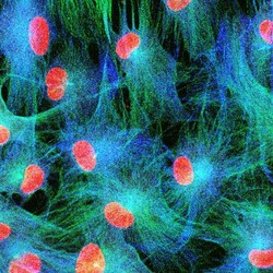 CoraLite Plus 488-conjugated Nestin Rabbit Polyclonal Antibody, Proteintech:Anticuerpos:Anticuerpos