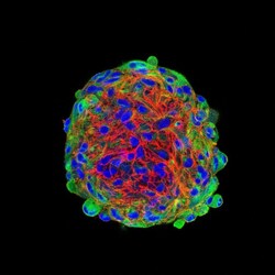CoraLite Plus 488-conjugated Nestin Rabbit Polyclonal Antibody, Proteintech:Anticuerpos:Anticuerpos