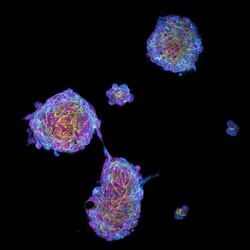 CoraLite Plus 488-conjugated Nestin Rabbit Polyclonal Antibody, Proteintech:Anticuerpos:Anticuerpos