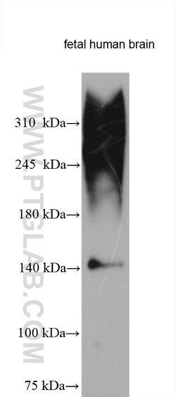 Neurocan Rabbit Polyclonal Antibody, Proteintech Unconjugated; 20 &mu;L:Antibodies,