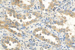 NeutraKine IL-10 Mouse Monoclonal Antibody, Proteintech Unconjugated; 100