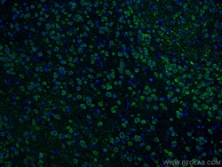 Notch1 Rabbit Polyclonal Antibody, Proteintech:Antibodies:Primary Antibodies