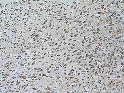 Notch1 Rabbit Polyclonal Antibody, Proteintech:Antibodies:Primary Antibodies