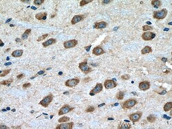 Notch1 Rabbit Polyclonal Antibody, Proteintech:Antibodies:Primary Antibodies