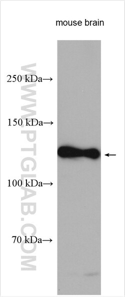 Notch1 Rabbit Polyclonal Antibody, Proteintech:Antibodies:Primary Antibodies