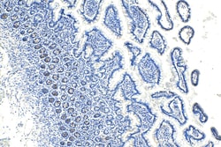 OLFM4 Rabbit Polyclonal Antibody, Proteintech:Antibodies:Primary Antibodies