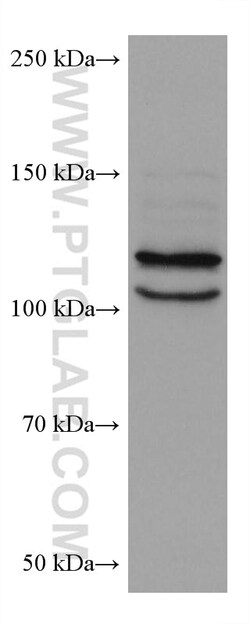 OSBPL5 Mouse Monoclonal Antibody, Proteintech:Antibodies:Primary Antibodies