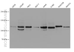 OSBPL5 Mouse Monoclonal Antibody, Proteintech:Antibodies:Primary Antibodies