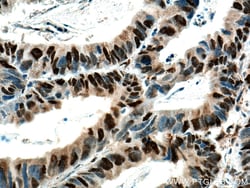 P53 Rabbit Recombinant Antibody, Proteintech:Antibodies:Primary Antibodies