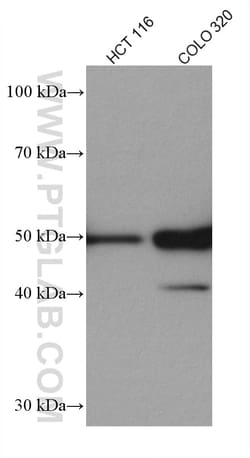 P53 Rabbit Recombinant Antibody, Proteintech:Antibodies:Primary Antibodies