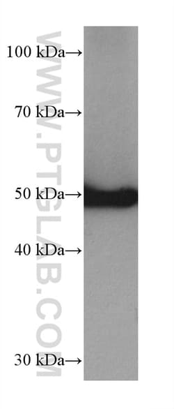 P53 Rabbit Recombinant Antibody, Proteintech:Antibodies:Primary Antibodies